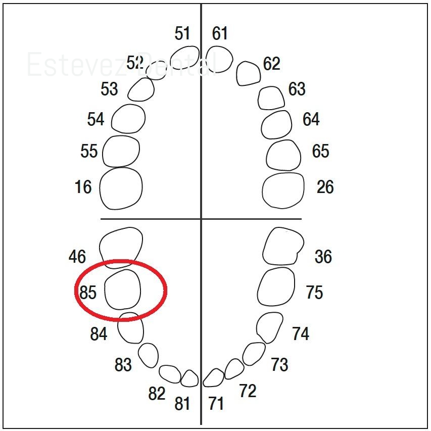 REPUESTO TIPODONTO AK-6/2 ZE-85
